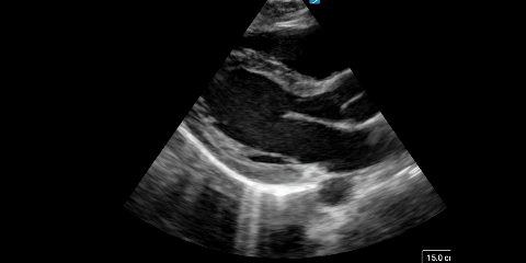 E learning tumbnail SpoedZorgAcademy E-Learning Cursussen